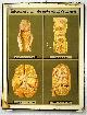  wall chart - Schoolplaat - School Poster - School chart - Teaching chart - poster - schoolkaart, ( SCHOOLPLAAT ) Tuberculose van de inwendige organen