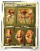  wall chart - Schoolplaat - School Poster - School chart - Teaching chart - poster - schoolkaart, ( SCHOOLPLAAT ) Gewrichtstuberculose